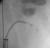 Xray shows the basket and cobra.